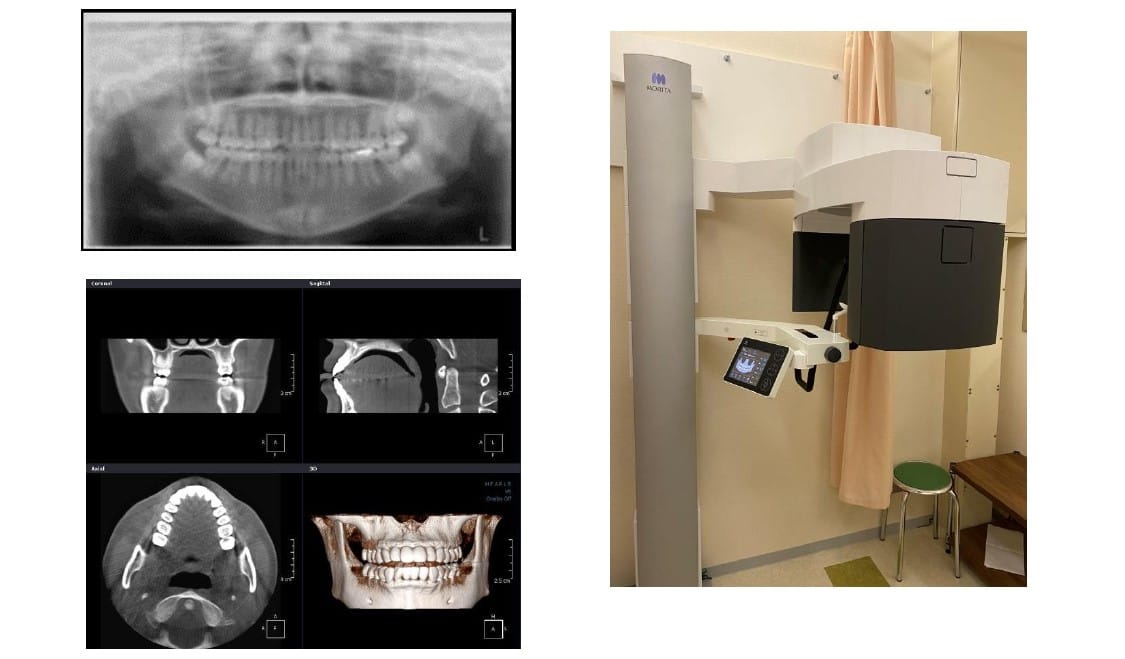 歯科用撮影画像