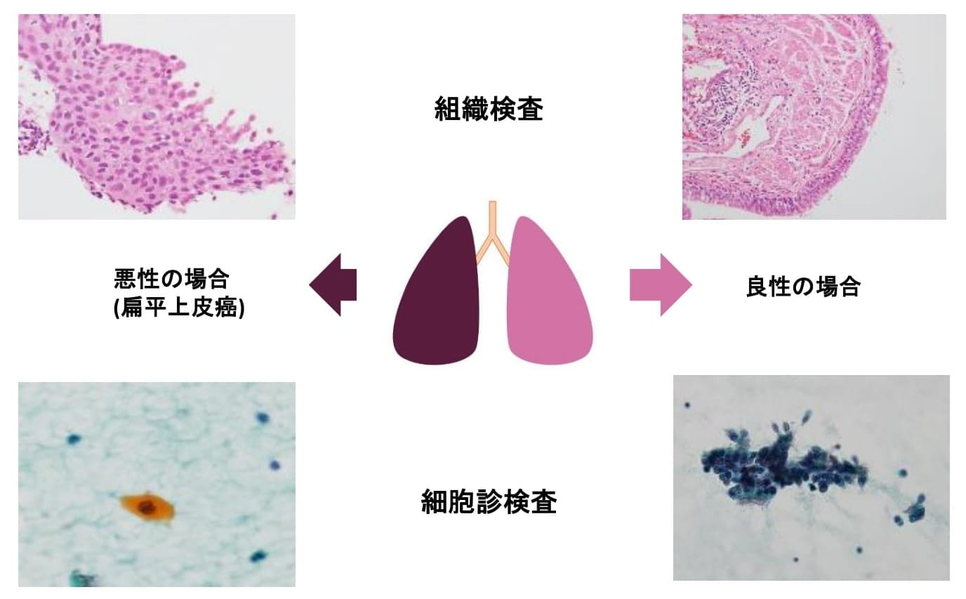 病理検査